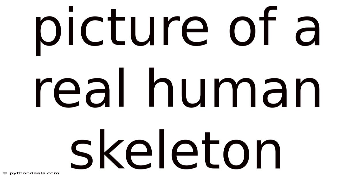 Picture Of A Real Human Skeleton