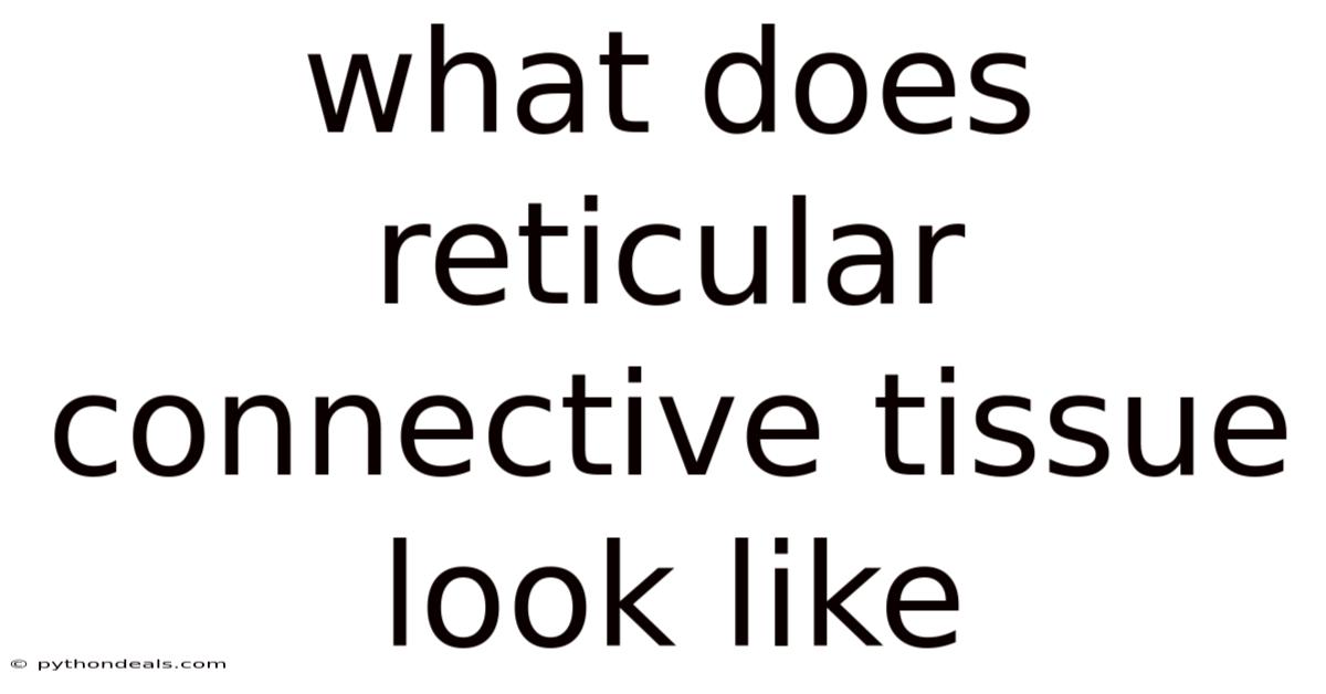 What Does Reticular Connective Tissue Look Like