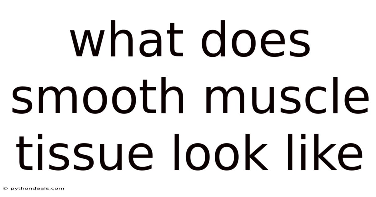 What Does Smooth Muscle Tissue Look Like